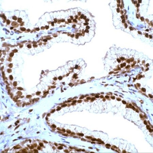 500uL Polyclonal antibody, p27Kip1, host