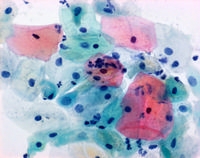 PAPANICOLAOUS LOESUNG 1A HARRIS' HAEMATO