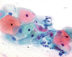 PAPANICOLAOUS LOESUNG 1B HAEMATOXYLINLOE