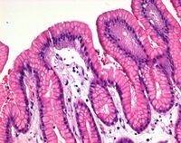 HAEMATOXYLIN-MONOHYDRAT (C.I. 75290) FUE