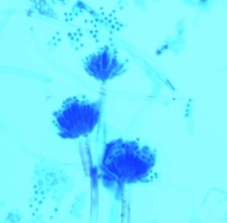 LACTOPHENOLBLAULOESUNG ZUR PILZFAERBUNG,
